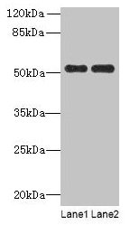 Western blot  | All lanes: PAH antibody at 2.5µg/ml  | Lane 1: Mouse kidney tissue  | Lane 2: Mouse liver tissue  | Secondary  | Goat polyclonal to rabbit IgG at 1/10000 dilution  | Predicted band size: 52 kDa  | Observed band size: 52 kDaRabbit anti-Human PAH Polyclonal Antibody