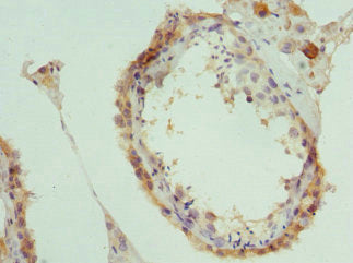 Immunohistochemistry of paraffin-embedded human testis tissue using PAICS Antibody at dilution of 1:100Rabbit anti-Human PAICS Polyclonal Antibody