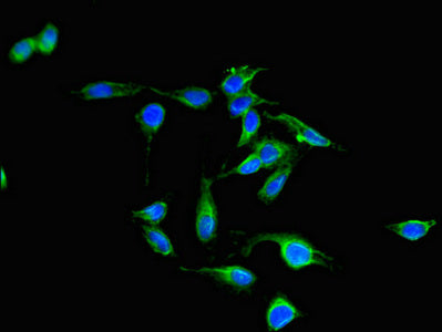 Immunofluorescent analysis of Hela cells using PAK3 Antibody at dilution of 1:100 and Alexa Fluor 488-congugated AffiniPure Goat Anti-Rabbit IgG(H+L)Rabbit anti-Human PAK3 Polyclonal Antibody