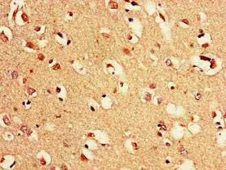 Immunohistochemistry of paraffin-embedded human brain tissue using PAK3 Antibody at dilution of 1:100Rabbit anti-Human PAK3 Polyclonal Antibody