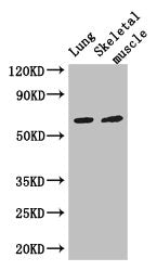 Western Blot | Positive WB detected in: Mouse lung tissue, Mouse skeletal muscle tissue | All lanes: PAK3 antibody at 3μg/ml | Secondary | Goat polyclonal to rabbit IgG at 1/50000 dilution | Predicted band size: 63, 61, 65 kDa | Observed band size: 63 kDaRabbit anti-Human PAK3 Polyclonal Antibody