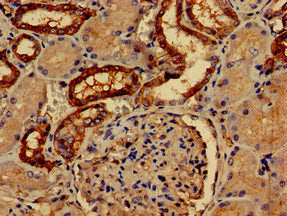 Immunohistochemistry of paraffin-embedded human kidney tissue using PALM Antibody at dilution of 1:100Rabbit anti-Human PALM Polyclonal Antibody
