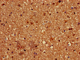 Immunohistochemistry of paraffin-embedded human brain tissue using PALM Antibody at dilution of 1:100Rabbit anti-Human PALM Polyclonal Antibody