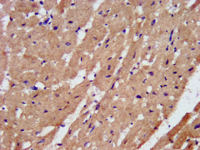 IHC image of PAM Antibody diluted at 1:200 and staining in paraffin-embedded human heart tissue performed on a Leica BondTM system. After dewaxing and hydration, antigen retrieval was mediated by high pressure in a citrate buffer (pH 6.0). Section was blocked with 10% normal goat serum 30min at RT. Then primary antibody (1% BSA) was incubated at 4°C overnight. The primary is detected by a biotinylated secondary antibody and visualized using an HRP conjugated SP system.Rabbit anti-Human PAM Polyclonal Antibody