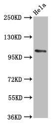 Western Blot  | Positive WB detected in: Hela whole cell lysate  | All lanes: PAM antibody at 5.6µg/ml  | Secondary  | Goat polyclonal to rabbit IgG at 1/50000 dilution  | Predicted band size: 109, 97, 101, 99, 107 kDa  | Observed band size: 109 kDaRabbit anti-Human PAM Polyclonal Antibody