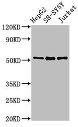 Western Blot  | Positive WB detected in: HepG2 whole cell lysate, SH-SY5Y whole cell lysate, Jurkat whole cell lysate  | All lanes: PRKN antibody at 3µg/ml  | Secondary  | Goat polyclonal to rabbit IgG at 1/50000 dilution  | Predicted band size: 52, 49, 24, 31, 43, 36, 44, 47 kDa  | Observed band size: 52 kDaRabbit anti-Human PRKN Polyclonal Antibody