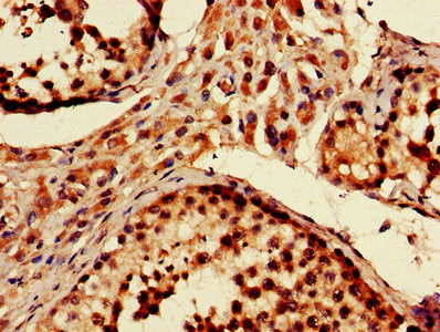 IHC image of PRKN Antibody diluted at 1:600 and staining in paraffin-embedded human testis tissue performed on a Leica BondTM system. After dewaxing and hydration, antigen retrieval was mediated by high pressure in a citrate buffer (pH 6.0). Section was blocked with 10% normal goat serum 30min at RT. Then primary antibody (1% BSA) was incubated at 4°C overnight. The primary is detected by a biotinylated secondary antibody and visualized using an HRP conjugated SP system.Rabbit anti-Human PRKN Polyclonal Antibody