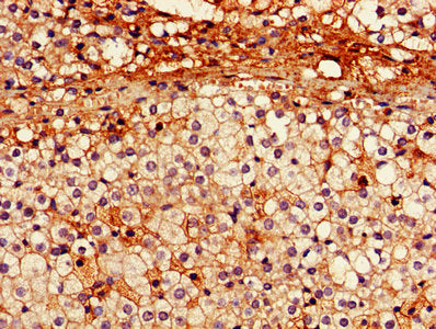 IHC image of PRKN Antibody diluted at 1:600 and staining in paraffin-embedded human adrenal gland tissue performed on a Leica BondTM system. After dewaxing and hydration, antigen retrieval was mediated by high pressure in a citrate buffer (pH 6.0). Section was blocked with 10% normal goat serum 30min at RT. Then primary antibody (1% BSA) was incubated at 4°C overnight. The primary is detected by a biotinylated secondary antibody and visualized using an HRP conjugated SP system.Rabbit anti-Human PRKN Polyclonal Antibody