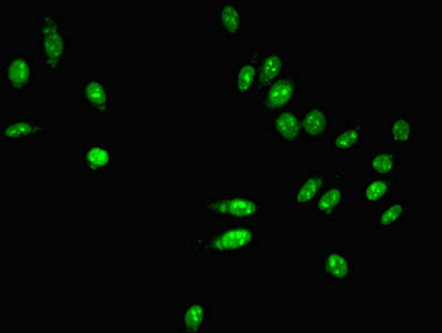Immunofluorescent analysis of Hela cells using PARN Antibody at dilution of 1:100 and Alexa Fluor 488-congugated AffiniPure Goat Anti-Rabbit IgG(H+L)