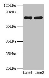 Western blot  | All lanes: PARN antibody at 2µg/ml  | Lane 1: Jurkat whole cell lysate  | Lane 2: A431 whole cell lysate  | Secondary  | Goat polyclonal to rabbit IgG at 1/10000 dilution  | Predicted band size: 74, 67, 68, 53 kDa  | Observed band size: 74 kDa