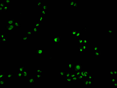 Immunofluorescence staining of Hela cells with PARP1 Antibody at 1:100, counter-stained with DAPI. The cells were fixed in 4% formaldehyde and blocked in 10% normal Goat Serum. The cells were then incubated with the antibody overnight at 4°C. The secondary antibody was Alexa Fluor 488-congugated AffiniPure Goat Anti-Rabbit IgG(H+L).Rabbit anti-Human PARP1 Polyclonal Antibody