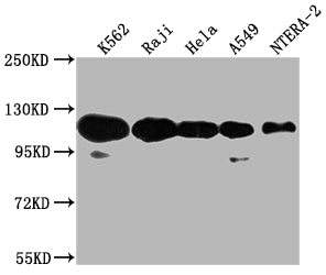 Western Blot | Positive WB detected in: K562 whole cell lysate, Raji whole cell lysate, Hela whole cell lysate, A549 whole cell lysate, NTERA-2 whole cell lysate | All lanes: PARP1 antibody at 1:2000 | Secondary | Goat polyclonal to rabbit IgG at 1/50000 dilution | Predicted band size: 114 kDa | Observed band size: 114 kDaRabbit anti-Human PARP1 Polyclonal Antibody