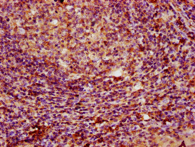 IHC image of PARP3 Antibody diluted at 1:100 and staining in paraffin-embedded human tonsil tissue performed on a Leica BondTM system. After dewaxing and hydration, antigen retrieval was mediated by high pressure in a citrate buffer (pH 6.0). Section was blocked with 10% normal goat serum 30min at RT. Then primary antibody (1% BSA) was incubated at 4°C overnight. The primary is detected by a biotinylated secondary antibody and visualized using an HRP conjugated SP system.Rabbit anti-Human PARP3 Polyclonal Antibody
