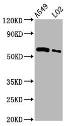 Western Blot  | Positive WB detected in: A549 whole cell lysate, LO2 whole cell lysate  | All lanes: PARP3 antibody at 3.5µg/ml  | Secondary  | Goat polyclonal to rabbit IgG at 1/50000 dilution  | Predicted band size: 61 kDa  | Observed band size: 61 kDaRabbit anti-Human PARP3 Polyclonal Antibody