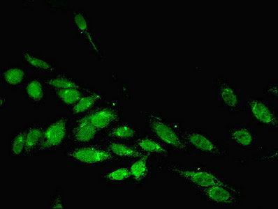 Immunofluorescent analysis of Hela cells using PARP3 Antibody at dilution of 1:100 and Alexa Fluor 488-congugated AffiniPure Goat Anti-Rabbit IgG(H+L)Rabbit anti-Human PARP3 Polyclonal Antibody