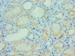 Immunohistochemistry of paraffin-embedded human kidney tissue using PARP3 Antibody at dilution of 1:100Rabbit anti-Human PARP3 Polyclonal Antibody