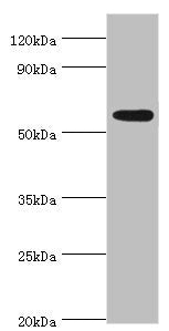 Western blot | All lanes: Poly [ADP-ribose] polymerase 3 antibody at 2μg/ml + Mouse heart tissue | Secondary | Goat polyclonal to rabbit IgG at 1/10000 dilution | Predicted band size: 60 kDa | Observed band size: 60 kDaRabbit anti-Human PARP3 Polyclonal Antibody