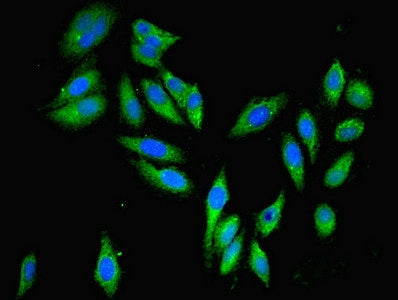 Immunofluorescent analysis of Hela cells using PARP3 Antibody at dilution of 1:100 and Alexa Fluor 488-congugated AffiniPure Goat Anti-Rabbit IgG(H+L)Rabbit anti-Human PARP3 Polyclonal Antibody