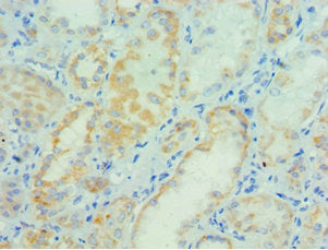 Immunohistochemistry of paraffin-embedded human kidney tissue using PARP3 Antibody at dilution of 1:100Rabbit anti-Human PARP3 Polyclonal Antibody
