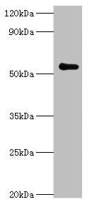 Western blot | All lanes: Poly [ADP-ribose] polymerase 3 antibody at 7μg/ml + Mouse kidney tissue | Secondary | Goat polyclonal to rabbit IgG at 1/10000 dilution | Predicted band size: 60 kDa | Observed band size: 60 kDaRabbit anti-Human PARP3 Polyclonal Antibody