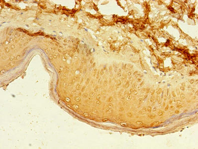 Immunohistochemistry of paraffin-embedded human skin tissue using PAX3 Antibody at dilution of 1:100Rabbit anti-Human PAX3 Polyclonal Antibody