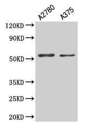 Western Blot  | Positive WB detected in: A2780 whole cell lysate, A375 whole cell lysate  | All lanes: PAX3 antibody at 5.3µg/ml  | Secondary  | Goat polyclonal to rabbit IgG at 1/50000 dilution  | Predicted band size: 53, 25, 23, 45, 46, 54, 56 kDa  | Observed band size: 53 kDaRabbit anti-Human PAX3 Polyclonal Antibody