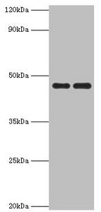 Western blot | All lanes: Paired box protein Pax-6 antibody at 1μg/ml | Lane 1: Mouse stomach tissue | Lane 2: Mouse eye tissue | Secondary | Goat polyclonal to rabbit IgG at 1/10000 dilution | Predicted band size: 47, 49 kDa | Observed band size: 47 kDaRabbit anti-Human PAX6 Polyclonal Antibody