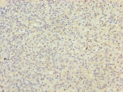 Immunohistochemistry of paraffin-embedded human spleen tissue using BUD31 Antibody at dilution of 1:100