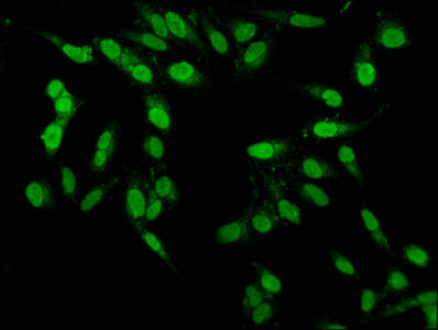 Immunofluorescence staining of Hela cells with PBX1 Antibody at 1:100, counter-stained with DAPI. The cells were fixed in 4% formaldehyde, permeabilized using 0.2% Triton X-100 and blocked in 10% normal Goat Serum. The cells were then incubated with the antibody overnight at 4°C. The secondary antibody was Alexa Fluor 488-congugated AffiniPure Goat Anti-Rabbit IgG(H+L).Rabbit anti-Human PBX1 Polyclonal Antibody