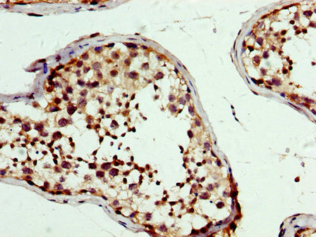 IHC image of PBX1 Antibody diluted at 1:300 and staining in paraffin-embedded human testis tissue performed on a Leica BondTM system. After dewaxing and hydration, antigen retrieval was mediated by high pressure in a citrate buffer (pH 6.0). Section was blocked with 10% normal goat serum 30min at RT. Then primary antibody (1% BSA) was incubated at 4°C overnight. The primary is detected by a biotinylated secondary antibody and visualized using an HRP conjugated SP system.Rabbit anti-Human PBX1 Polyclonal Antibody