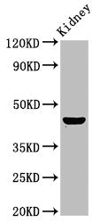 Western Blot | Positive WB detected in: Rat kidney tissue | All lanes: PBX1 antibody at 4.7μg/ml | Secondary | Goat polyclonal to rabbit IgG at 1/50000 dilution | Predicted band size: 47, 39 kDa | Observed band size: 47 kDaRabbit anti-Human PBX1 Polyclonal Antibody