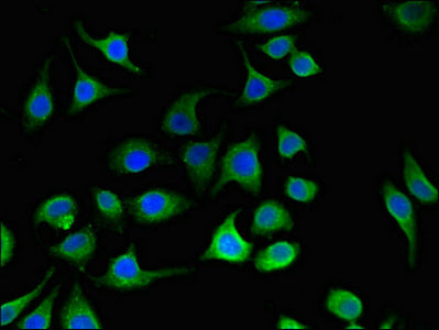 Immunofluorescent analysis of A549 cells using PC Antibody at dilution of 1:100 and Alexa Fluor 488-congugated AffiniPure Goat Anti-Rabbit IgG(H+L)Rabbit anti-Human PC Polyclonal Antibody