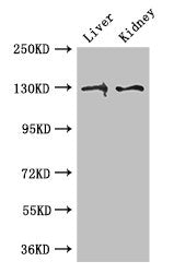 Western Blot | Positive WB detected in: Mouse liver tissue, Mouse kidney tissue | All lanes: PC antibody at 3μg/ml | Secondary | Goat polyclonal to rabbit IgG at 1/50000 dilution | Predicted band size: 130, 58 kDa | Observed band size: 130 kDaRabbit anti-Human PC Polyclonal Antibody