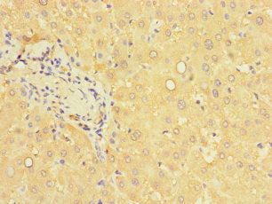 Immunohistochemistry of paraffin-embedded human liver tissue using the antibody at dilution of 1:100Rabbit anti-Human PCBD1 Polyclonal Antibody