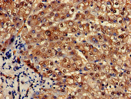 Immunohistochemistry of paraffin-embedded human liver tissue using PCCA Antibody at dilution of 1:100Rabbit anti-Human PCCA Polyclonal Antibody