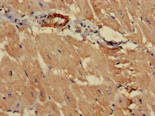 Immunohistochemistry of paraffin-embedded human heart tissue using PCCA Antibody at dilution of 1:100Rabbit anti-Human PCCA Polyclonal Antibody