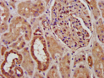 IHC image of PCCB Antibody diluted at 1:300 and staining in paraffin-embedded human kidney tissue performed on a Leica BondTM system. After dewaxing and hydration, antigen retrieval was mediated by high pressure in a citrate buffer (pH 6.0). Section was blocked with 10% normal goat serum 30min at RT. Then primary antibody (1% BSA) was incubated at 4°C overnight. The primary is detected by a biotinylated secondary antibody and visualized using an HRP conjugated SP system.Rabbit anti-Human PCCB Polyclonal Antibody
