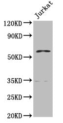 Western Blot  | Positive WB detected in: Jurkat whole cell lysate  | All lanes: PCCB antibody at 7.7µg/ml  | Secondary  | Goat polyclonal to rabbit IgG at 1/50000 dilution  | Predicted band size: 59, 61 kDa  | Observed band size: 59 kDaRabbit anti-Human PCCB Polyclonal Antibody