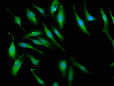 Immunofluorescence staining of Hela cells with PCMT1 Antibody at 1:66, counter-stained with DAPI. The cells were fixed in 4% formaldehyde, permeabilized using 0.2% Triton X-100 and blocked in 10% normal Goat Serum. The cells were then incubated with the antibody overnight at 4°C. The secondary antibody was Alexa Fluor 488-congugated AffiniPure Goat Anti-Rabbit IgG(H+L).Rabbit anti-Human PCMT1 Polyclonal Antibody