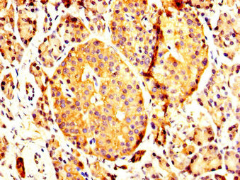 IHC image of the antibody diluted at 1:200 and staining in paraffin-embedded human pancreatic tissue performed on a Leica BondTM system. After dewaxing and hydration, antigen retrieval was mediated by high pressure in a citrate buffer (pH 6.0). Section was blocked with 10% normal goat serum 30min at RT. Then primary antibody (1% BSA) was incubated at 4°C overnight. The primary is detected by a biotinylated secondary antibody and visualized using an HRP conjugated SP system.Rabbit anti-Human PCMT1 Polyclonal Antibody