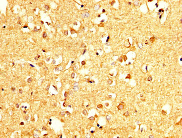 IHC image of PCMT1 Antibody diluted at 1:200 and staining in paraffin-embedded human brain tissue performed on a Leica BondTM system. After dewaxing and hydration, antigen retrieval was mediated by high pressure in a citrate buffer (pH 6.0). Section was blocked with 10% normal goat serum 30min at RT. Then primary antibody (1% BSA) was incubated at 4°C overnight. The primary is detected by a biotinylated secondary antibody and visualized using an HRP conjugated SP system.Rabbit anti-Human PCMT1 Polyclonal Antibody