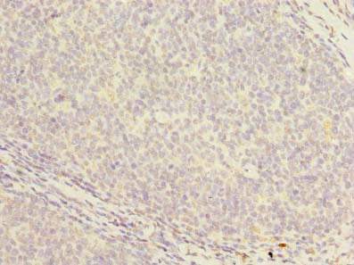 Immunohistochemistry of paraffin-embedded human tonsil tissue using PCOLCE2 Antibody at dilution of 1:100Rabbit anti-Human PCOLCE2 Polyclonal Antibody