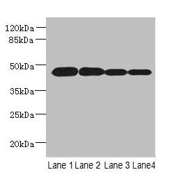 Western blot  | All lanes: PCOLCE2 antibody at 8µg/ml  | Lane 1: MCF-7 whole cell lysate  | Lane 2: A549 whole cell lysate  | Lane 3: HCT116 whole cell lysate  | Lane 4: Human high value serum  | Secondary  | Goat polyclonal to rabbit IgG at 1/10000 dilution  | Predicted band size: 46 kDa  | Observed band size: 46 kDaRabbit anti-Human PCOLCE2 Polyclonal Antibody