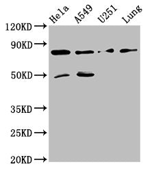 Western Blot | Positive WB detected in: Hela whole cell lysate, A549 whole cell lysate, U251 whole cell lysate, Mouse lung tissue | All lanes: Pcsk1 antibody at 8μg/ml | Secondary | Goat polyclonal to rabbit IgG at 1/50000 dilution | Predicted band size: 85 kDa | Observed band size: 85 kDaRabbit anti-Human PCSK2 Polyclonal Antibody