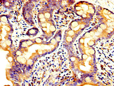 IHC image of PCSK5 Antibody diluted at 1:300 and staining in paraffin-embedded human small intestine tissue performed on a Leica BondTM system. After dewaxing and hydration, antigen retrieval was mediated by high pressure in a citrate buffer (pH 6.0). Section was blocked with 10% normal goat serum 30min at RT. Then primary antibody (1% BSA) was incubated at 4°C overnight. The primary is detected by a biotinylated secondary antibody and visualized using an HRP conjugated SP system.Rabbit anti-Human PCSK5 Polyclonal Antibody