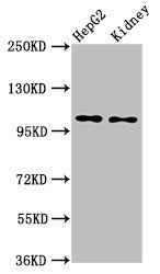 Western Blot  | Positive WB detected in: HepG2 whole cell lysate, Rat kidney tissue  | All lanes: PCSK5 antibody at 6µg/ml  | Secondary  | Goat polyclonal to rabbit IgG at 1/50000 dilution  | Predicted band size: 207, 102 kDa  | Observed band size: 102 kDaRabbit anti-Human PCSK5 Polyclonal Antibody