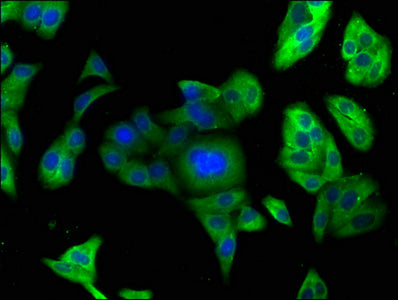 Immunofluorescence staining of HepG2 cells with PCSK9 Antibody at 1:166, counter-stained with DAPI. The cells were fixed in 4% formaldehyde, permeabilized using 0.2% Triton X-100 and blocked in 10% normal Goat Serum. The cells were then incubated with the antibody overnight at 4°C. The secondary antibody was Alexa Fluor 488-congugated AffiniPure Goat Anti-Rabbit IgG(H+L).Rabbit anti-Human PCSK9 Polyclonal Antibody