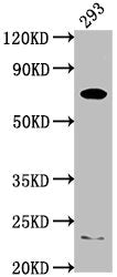 Western Blot | Positive WB detected in: 293 whole cell lysate | All lanes: PCSK9 antibody at 1:2000 | Secondary | Goat polyclonal to rabbit IgG at 1/50000 dilution | Predicted band size: 75, 21 kDa | Observed band size: 75 kDaRabbit anti-Human PCSK9 Polyclonal Antibody