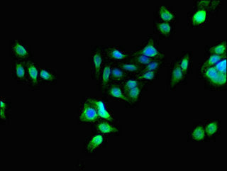 Immunofluorescent analysis of HepG2 cells using PCTP Antibody at dilution of 1:100 and Alexa Fluor 488-congugated AffiniPure Goat Anti-Rabbit IgG(H+L)Rabbit anti-Human PCTP Polyclonal Antibody