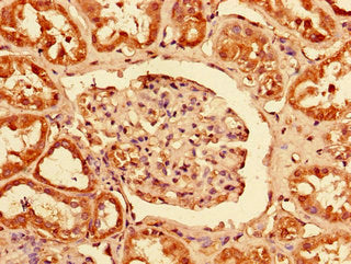 Immunohistochemistry of paraffin-embedded human kidney tissue using PCTP Antibody at dilution of 1:100Rabbit anti-Human PCTP Polyclonal Antibody